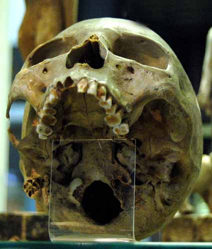 skull 1