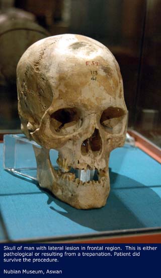 skull001